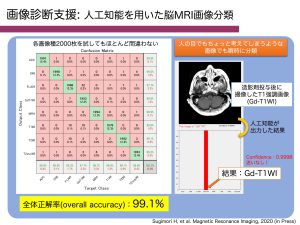 脳MRI画像種の分類